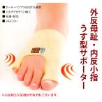  вальгусная деформация первого пальца стопы внутри . маленький палец легкий type опора тонкий опора антибактериальный дезодорация mre трудно пара палец открывать шелк протеин .. тип туфли-лодочки 