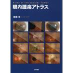 眼内腫瘍アトラス