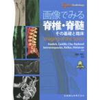 画像でみる脊椎・脊髄 その基礎と臨床 Expert Radiology