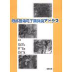 眼部腫瘍電子顕微鏡アトラス