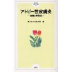アトピー性皮膚炎 治療と予防法