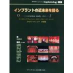 インプラントの近未来を探る