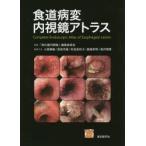 食道病変内視鏡アトラス