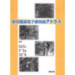 眼部腫瘍電子顕微鏡アトラス