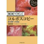 動画で学ぶコルポスコピー 新分類への対応