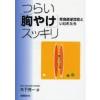 つらい「胸やけ」スッキリ 胃食道逆流症といわれたら