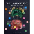 コンピュータガイドシステム 低侵襲で安全なインプラント治療