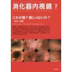 消化器内視鏡 Vol.26No.7（2014July）