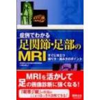 症例でわかる足関節・足部のMRI すぐに役立つ撮り方・読み方のポイント / 小橋由紋子  〔本〕