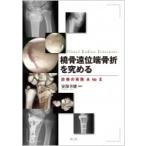 橈骨遠位端骨折を究める 診療の実践A to Z 安部幸雄／編集 整形外