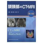 頭頸部のCT・MRI 第3版 頭頸部のCT・MRI 第3版 | 尾尻博也, 酒井 修 |本 | 通販 | Amazon