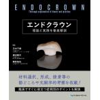  end Crown / правильный дерево тысяч .