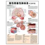 [...... disease (COPD) ] medicine poster poster B3 size human body anatomy map poster medicine chart 