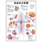 [ высокое кровяное давление. знания ] медицина постер постер B3 размер тело человека анатомия map постер медицина chart 
