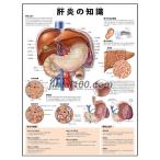 「肝炎の知識」医学ポスター ポスターB3サイズ  人体解剖学図ポスター 医学チャート