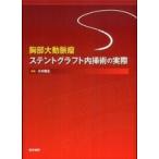 胸部大動脈瘤ステントグラフト内挿術の実際
