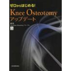  Zero из впервые .!Knee Osteotomy выше te-to