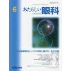 a. казаться глаз .(Vol.43 No.6(Jun) специальный выпуск : новейший глаз внутри линзы. особенность . выбор person * мой ..