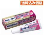  новый поли рукоятка устойчивость & удобный Fit EX 40g