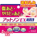 定形外）【第2類医薬品】アットノンＥＸ　ジェル　15g