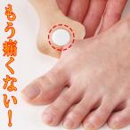 外反母趾 ガイハン出っ張り サポーター 外反母趾サポーター がいはんぼし 保護 メール便 爆買