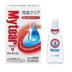 【第2類医薬品】マイティアV(15ml) 目薬
