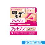 アットノンt コンシーラータイプ 10g (1個)  第２類医薬品