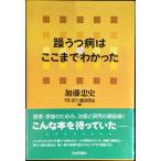 躁うつ病はここまでわかった