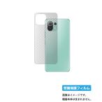 Xiaomi Mi 11 Lite 5G 用 カーボン調 背面保護フィルム ポスト投函は送料無料