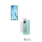 ショッピングmi 11 lite 5g 2枚組(画面+背面) Xiaomi Mi 11 Lite 5G 用 反射防止ノンフィラータイプ 液晶保護フィルム ＋カーボン調背面保護フィルム ポスト投函は送料無料