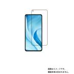 ショッピングmi 11 lite 5g 2枚セット Xiaomi Mi 11 Lite 5G 用 防指紋光沢 液晶保護フィルム ポスト投函は送料無料
