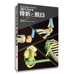 ソフトウェア 「３Dで分かる 骨折と