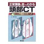 Yahoo! Yahoo!ショッピング(ヤフー ショッピング)正常画像と並べてわかる頭部ＣＴ／藤原卓哉