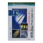 ko волчок мог прозрачный полимер |. рука документ самец 