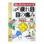 治し方がよくわかる疲れ目・目の痛み／戸張幾生