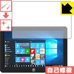 MageDok 8.9 дюймовый Portable Monitor (089A) природа . есть ..... царапина . восстановление! защитная плёнка царапина сам восстановление 