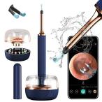 耳かき カメラ BEBIRD? Note3 Pro 2021最新型 メカニカルアーム付きみみかき 1000W画素 極細レンズ ピンセットとイヤ?