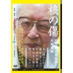 核の傷:肥田舜太郎医師と内部被曝 DVD