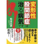 変形性股関節症は治る病気です (ワニプラス)
