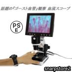  observation .. scope * wool small blood vessel microscope 880+600 times +8 -inch screen . clear 