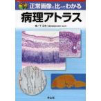 正常画像と比べてわかる病理アトラス
