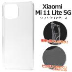 ショッピングmi 11 lite 5g Xiaomi Mi 11 Lite 5G用マイクロドット ソフトクリアケース