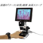観察 血流スコープ◆毛細血管 顕微鏡880+600倍+8インチ画面をクリア