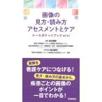 渕本雅昭 画像の見方・読み方アセスメントとケアナースポケットブックmi Book
