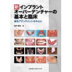 新インプラントオーバーデンチャーの基本と臨床 磁性アタッチメントを