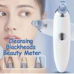  шерсть дыра аспиратор белый тип аккумулятора ( продается отдельно ) шерсть дыра уход носовые волосы дыра почернение шерсть дыра загрязнения клубника нос клубника нос уход за кожей почернение уход угол штекер всасывание удаление угри всасывание угол штекер удаление 