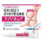 その他皮膚の薬