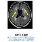 MRI脳ドック診察利用権