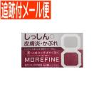 [ слежение есть почтовая доставка бесплатная доставка ][ no. (2) вид фармацевтический препарат ] moa штраф PVA..20g