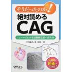 そうだったのか!絶対読めるCAG-シェ−マでわかる冠動脈造影の読み方
